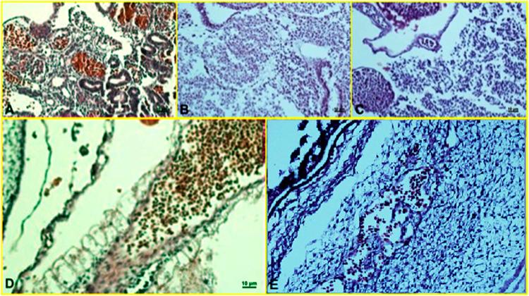 https://cdn.ncbi.nlm.nih.gov/pmc/blobs/71b0/9214246/45be03dee830/fphar-13-860598-g008.jpg