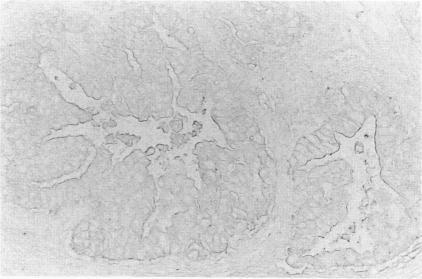 https://cdn.ncbi.nlm.nih.gov/pmc/blobs/71b1/1886266/76dc5f5fcec7/amjpathol00099-0054-b.jpg