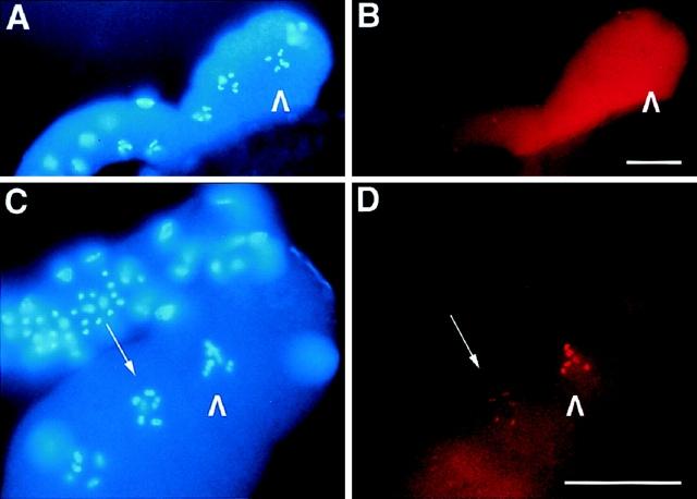 https://cdn.ncbi.nlm.nih.gov/pmc/blobs/71b1/2132979/1a499c82ab6d/JCB9807011.f4.jpg
