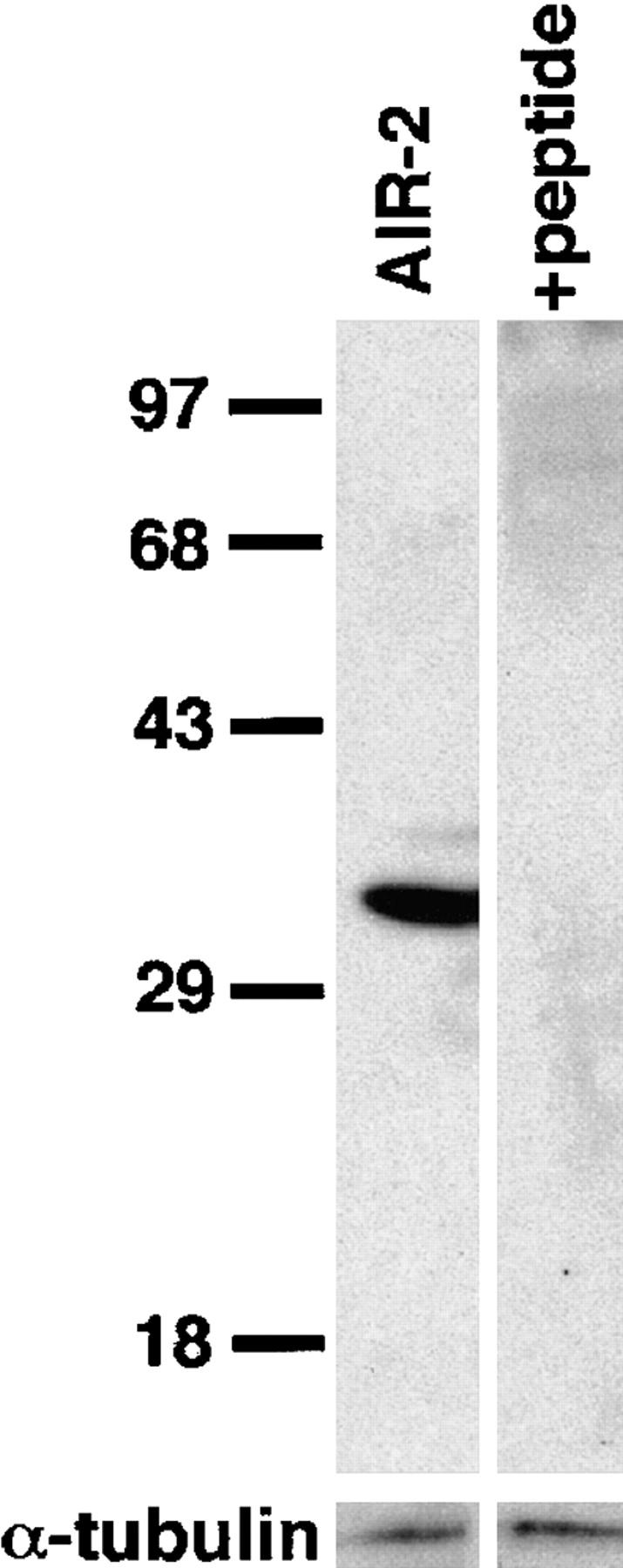 https://cdn.ncbi.nlm.nih.gov/pmc/blobs/71b1/2132979/64848969470d/JCB9807011.f2.jpg