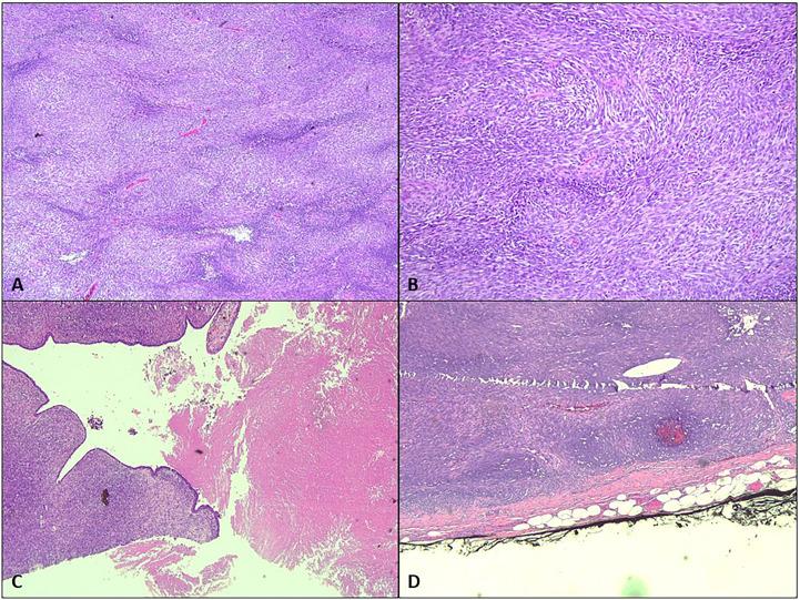 https://cdn.ncbi.nlm.nih.gov/pmc/blobs/71b6/10080590/ff6512b5593c/fonc-13-1034556-g003.jpg