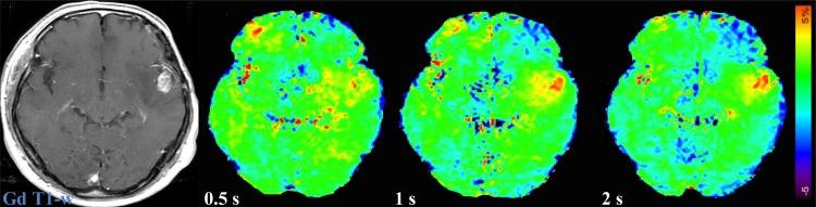 https://cdn.ncbi.nlm.nih.gov/pmc/blobs/71b9/4881971/280c6a4390cc/pone.0155925.g006.jpg