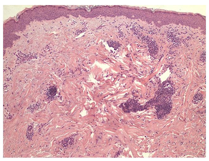 https://cdn.ncbi.nlm.nih.gov/pmc/blobs/71b9/9369885/31adeace9c7d/jcm-11-04474-g005.jpg
