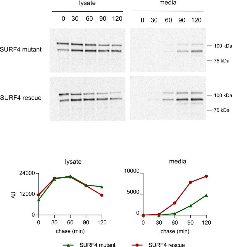 https://cdn.ncbi.nlm.nih.gov/pmc/blobs/71bc/6156083/c0b33be244a7/elife-38839-fig5-figsupp1.jpg