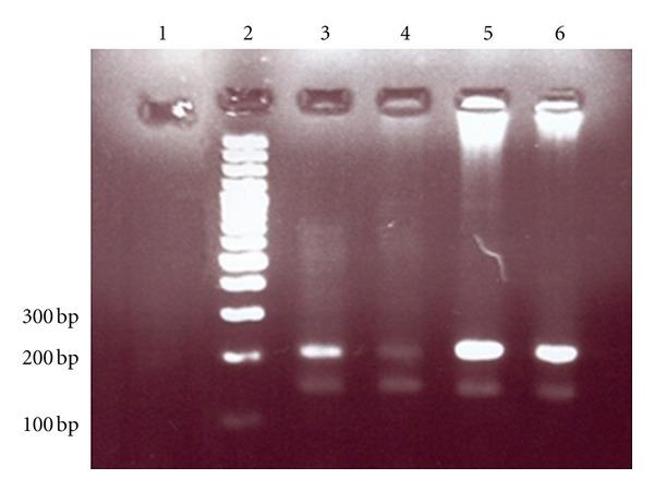 https://cdn.ncbi.nlm.nih.gov/pmc/blobs/71bd/3505638/669267572be1/ISRN.OBGYN2012-975135.001.jpg