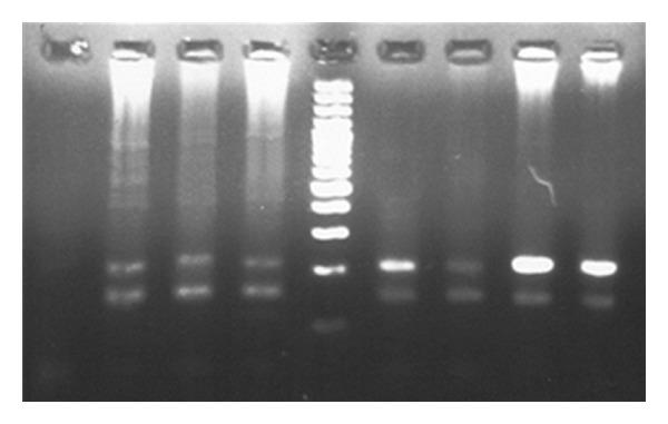 https://cdn.ncbi.nlm.nih.gov/pmc/blobs/71bd/3505638/d551687b37ca/ISRN.OBGYN2012-975135.003.jpg