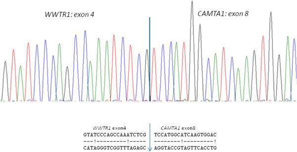https://cdn.ncbi.nlm.nih.gov/pmc/blobs/71be/4100035/4579cb33207f/1746-1596-9-131-8.jpg