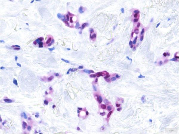https://cdn.ncbi.nlm.nih.gov/pmc/blobs/71be/4100035/66761c58cda2/1746-1596-9-131-6.jpg
