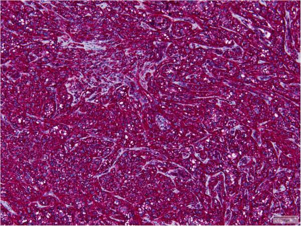 https://cdn.ncbi.nlm.nih.gov/pmc/blobs/71be/4100035/af288839429a/1746-1596-9-131-5.jpg