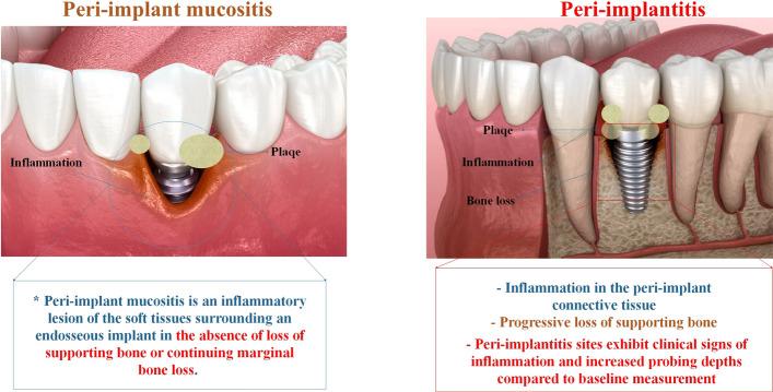 https://cdn.ncbi.nlm.nih.gov/pmc/blobs/71c7/11470642/1b63e383b122/12938_2024_1294_Fig1_HTML.jpg