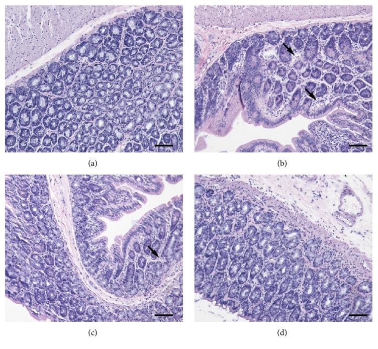https://cdn.ncbi.nlm.nih.gov/pmc/blobs/71d2/6186382/306ed3375741/ECAM2018-4280343.006.jpg