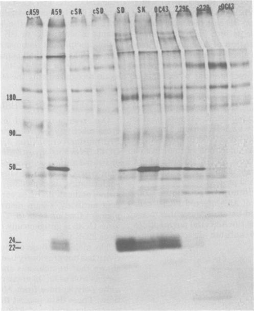 https://cdn.ncbi.nlm.nih.gov/pmc/blobs/71d7/171144/27a261409257/jvirol00004-0244-a.jpg