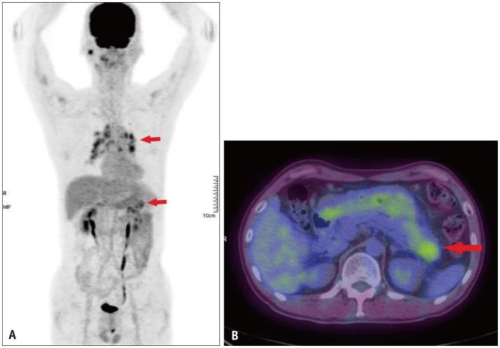 https://cdn.ncbi.nlm.nih.gov/pmc/blobs/71d8/10248362/b0bde2d5e727/kjr-24-590-g003.jpg