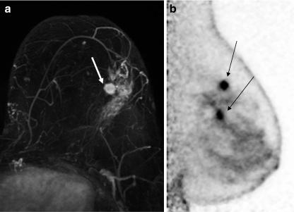 https://cdn.ncbi.nlm.nih.gov/pmc/blobs/71e2/3005116/00d018d883c6/259_2010_1588_Fig3_HTML.jpg