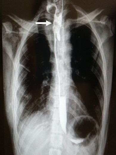 https://cdn.ncbi.nlm.nih.gov/pmc/blobs/71f4/5579447/9b7bcb9ebfd1/PAMJ-27-207-g003.jpg