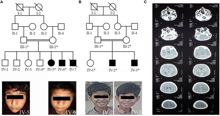 https://cdn.ncbi.nlm.nih.gov/pmc/blobs/7200/10249782/4da898d3b833/fneur-14-1168307-g0001.jpg