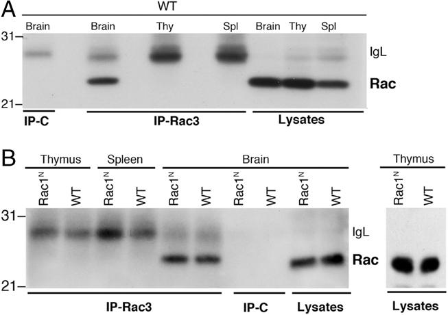 https://cdn.ncbi.nlm.nih.gov/pmc/blobs/7201/3132589/ae644d964881/eji0041-1410-f5.jpg