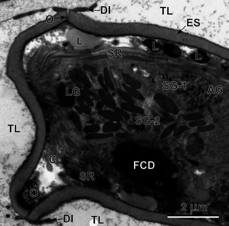 https://cdn.ncbi.nlm.nih.gov/pmc/blobs/7201/3932163/55c7abdb9ec6/436_2013_3747_Fig5_HTML.jpg