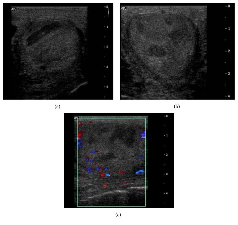 https://cdn.ncbi.nlm.nih.gov/pmc/blobs/7203/5299182/17570cb773fe/CRIRA2017-8923621.001.jpg