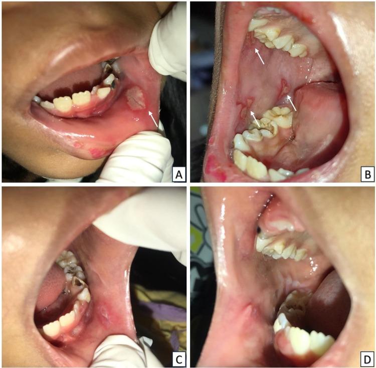 https://cdn.ncbi.nlm.nih.gov/pmc/blobs/7205/11288364/fc22aacc061d/HIV-16-289-g0003.jpg