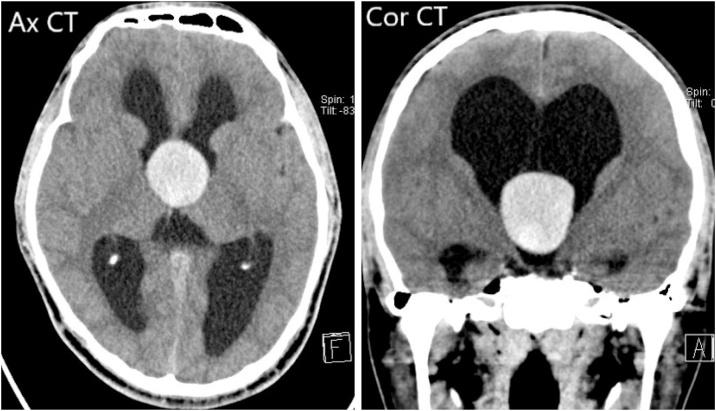 https://cdn.ncbi.nlm.nih.gov/pmc/blobs/7208/7586049/51e20da8a7cb/gr1.jpg