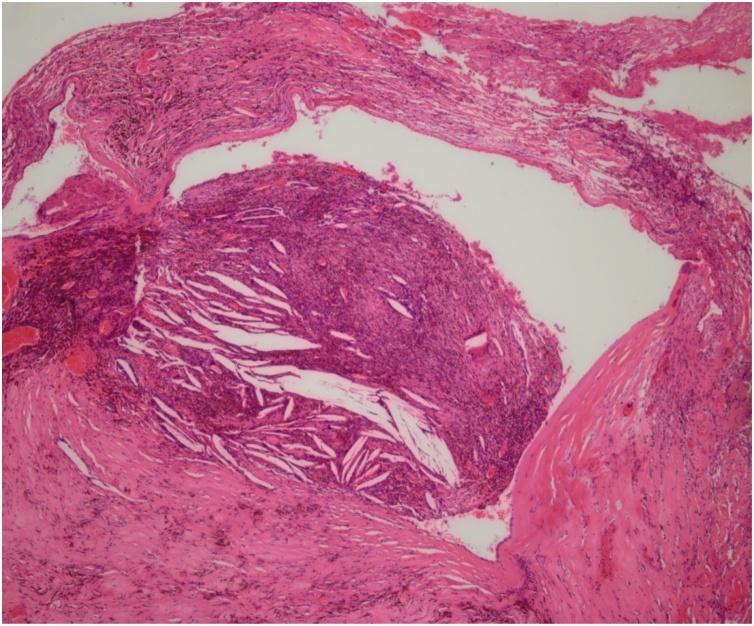 https://cdn.ncbi.nlm.nih.gov/pmc/blobs/7208/7586049/736ee2dfd095/gr6.jpg