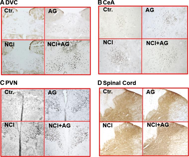 https://cdn.ncbi.nlm.nih.gov/pmc/blobs/720a/5559576/ee2a67a7c9a7/10620_2017_4487_Fig3_HTML.jpg
