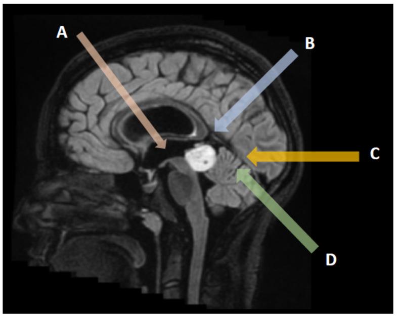https://cdn.ncbi.nlm.nih.gov/pmc/blobs/720a/9367474/aaa6f202bae0/cancers-14-03646-g002.jpg