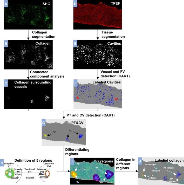 https://cdn.ncbi.nlm.nih.gov/pmc/blobs/7215/12320568/9cbcb8cfc554/LIV-45-0-g003.jpg