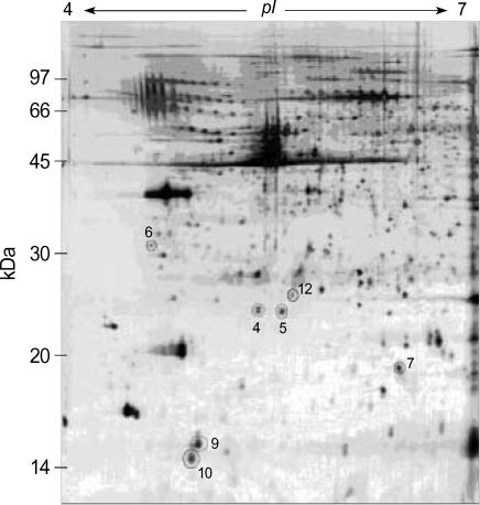 https://cdn.ncbi.nlm.nih.gov/pmc/blobs/7216/2779299/ce0356617305/jkms-20-1000-g002.jpg