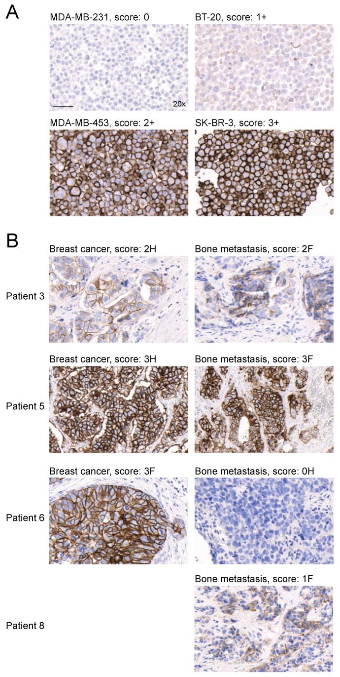 https://cdn.ncbi.nlm.nih.gov/pmc/blobs/721d/10341074/b04ff2361758/cancers-15-03419-g006.jpg