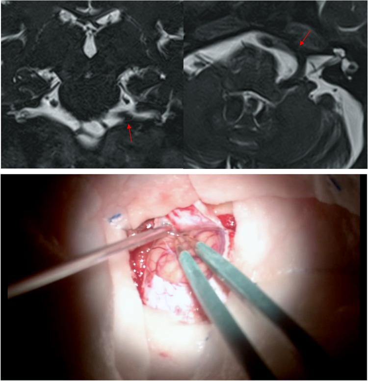 https://cdn.ncbi.nlm.nih.gov/pmc/blobs/7225/11919959/1ba56ef0ee49/701_2025_6472_Fig5_HTML.jpg