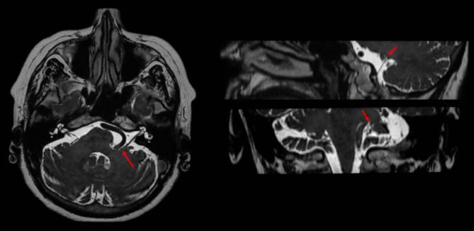https://cdn.ncbi.nlm.nih.gov/pmc/blobs/7225/11919959/4ad3f7b16f1d/701_2025_6472_Fig1_HTML.jpg