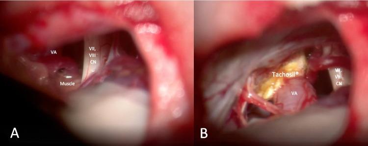 https://cdn.ncbi.nlm.nih.gov/pmc/blobs/7225/11919959/581884f91278/701_2025_6472_Fig4_HTML.jpg