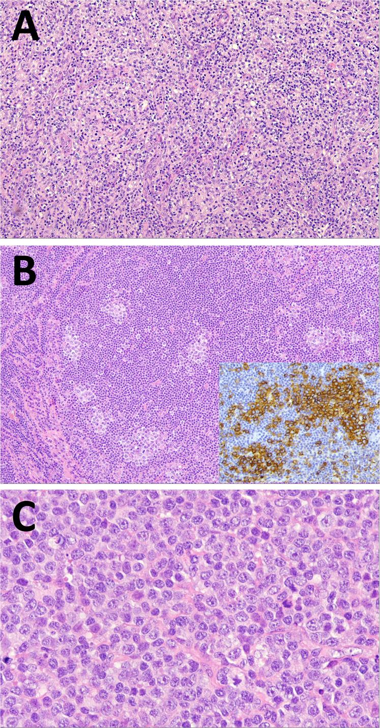 https://cdn.ncbi.nlm.nih.gov/pmc/blobs/7225/9252901/c065f217e21e/41375_2022_1620_Fig7_HTML.jpg