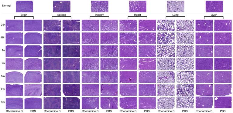 https://cdn.ncbi.nlm.nih.gov/pmc/blobs/722e/11628308/943335e30773/fmed-11-1461520-g011.jpg