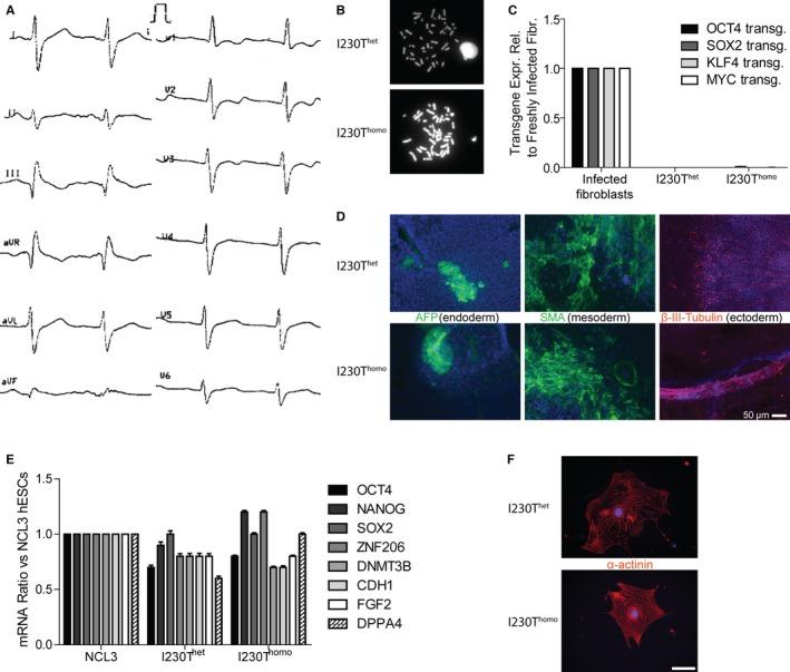 https://cdn.ncbi.nlm.nih.gov/pmc/blobs/7235/5586268/33c9d67a9160/JAH3-6-e005135-g001.jpg
