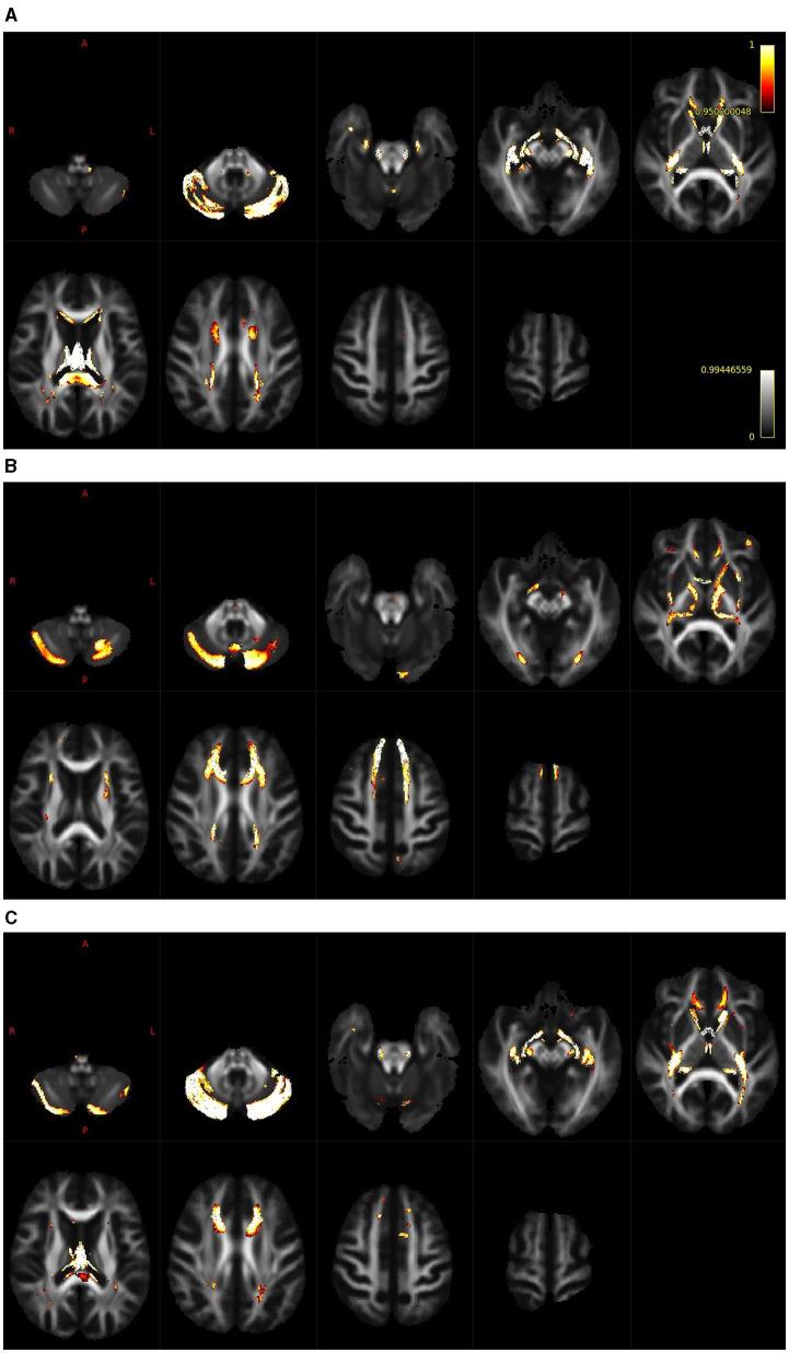 https://cdn.ncbi.nlm.nih.gov/pmc/blobs/7237/10803717/7f701e4877ba/fnagi-15-1283660-g0003.jpg