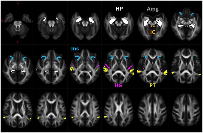 https://cdn.ncbi.nlm.nih.gov/pmc/blobs/7237/10803717/ffbe06f9811a/fnagi-15-1283660-g0001.jpg