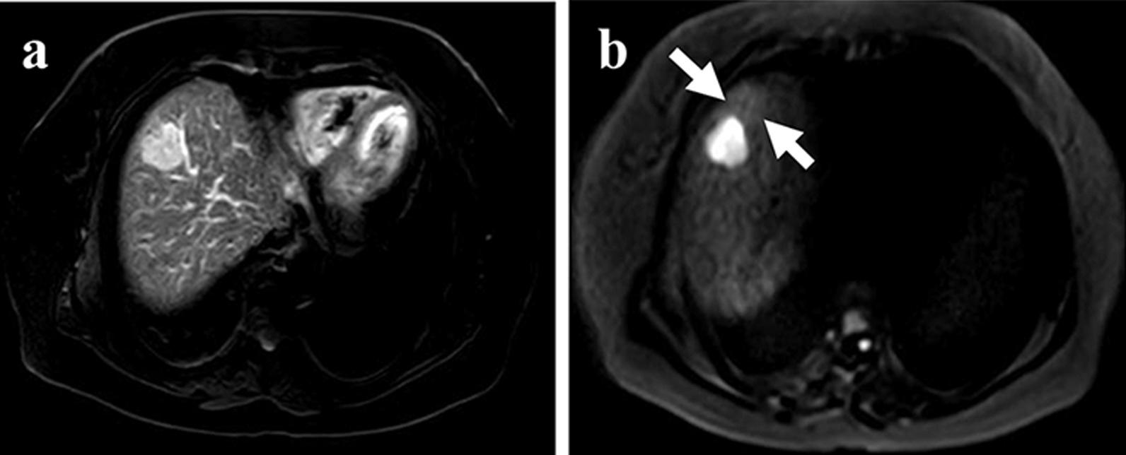https://cdn.ncbi.nlm.nih.gov/pmc/blobs/7238/7934549/22a44f485f6b/12880_2021_572_Fig2_HTML.jpg