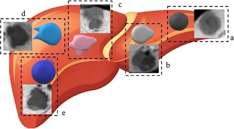 https://cdn.ncbi.nlm.nih.gov/pmc/blobs/7238/7934549/faec8c3cbdd1/12880_2021_572_Fig4_HTML.jpg