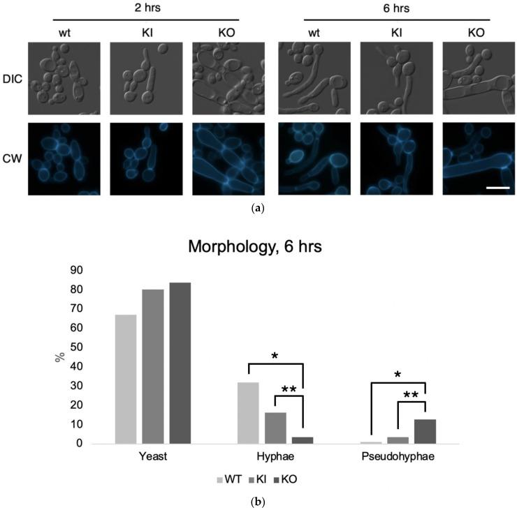 https://cdn.ncbi.nlm.nih.gov/pmc/blobs/723d/10672141/f8dea647e994/jof-09-01097-g006a.jpg