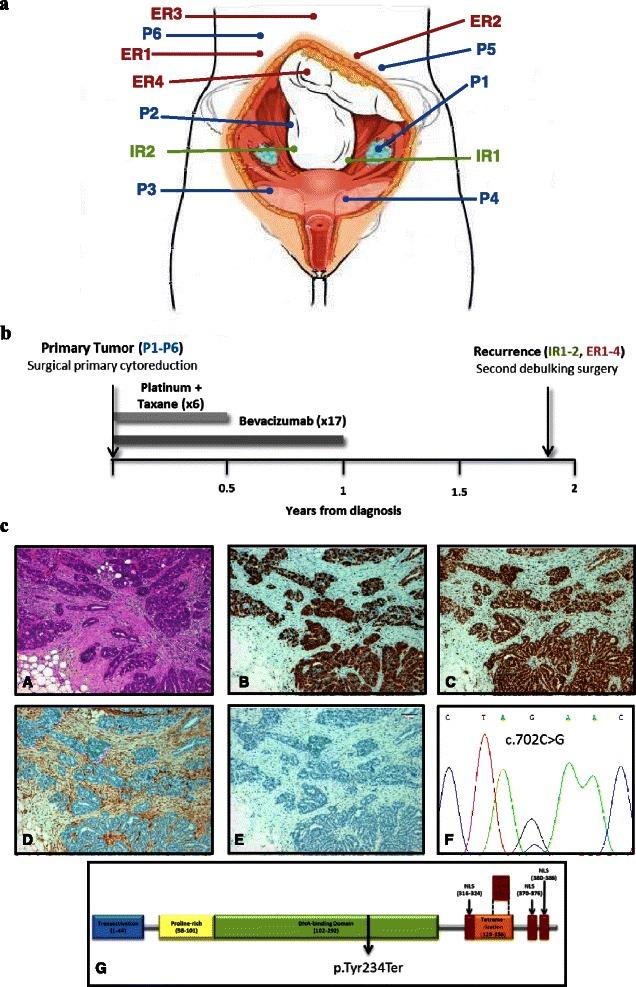 https://cdn.ncbi.nlm.nih.gov/pmc/blobs/7242/4666042/4c75560409ee/12885_2015_1952_Fig1_HTML.jpg