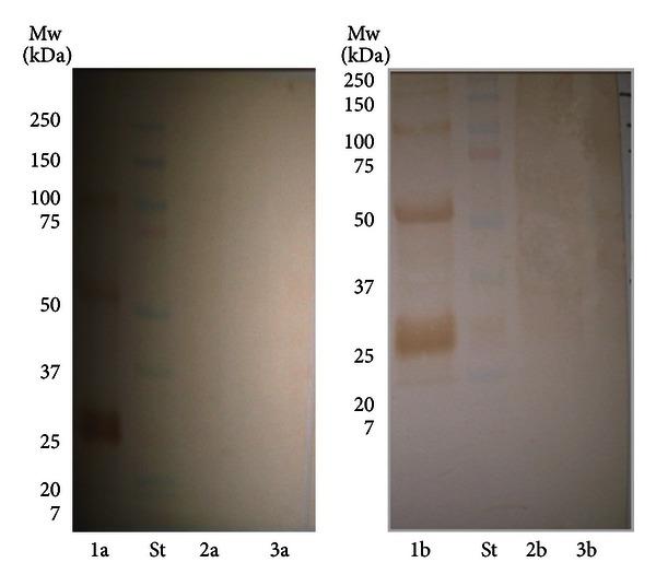 https://cdn.ncbi.nlm.nih.gov/pmc/blobs/7248/3666391/55fedcef2525/AD2013-728720.002.jpg