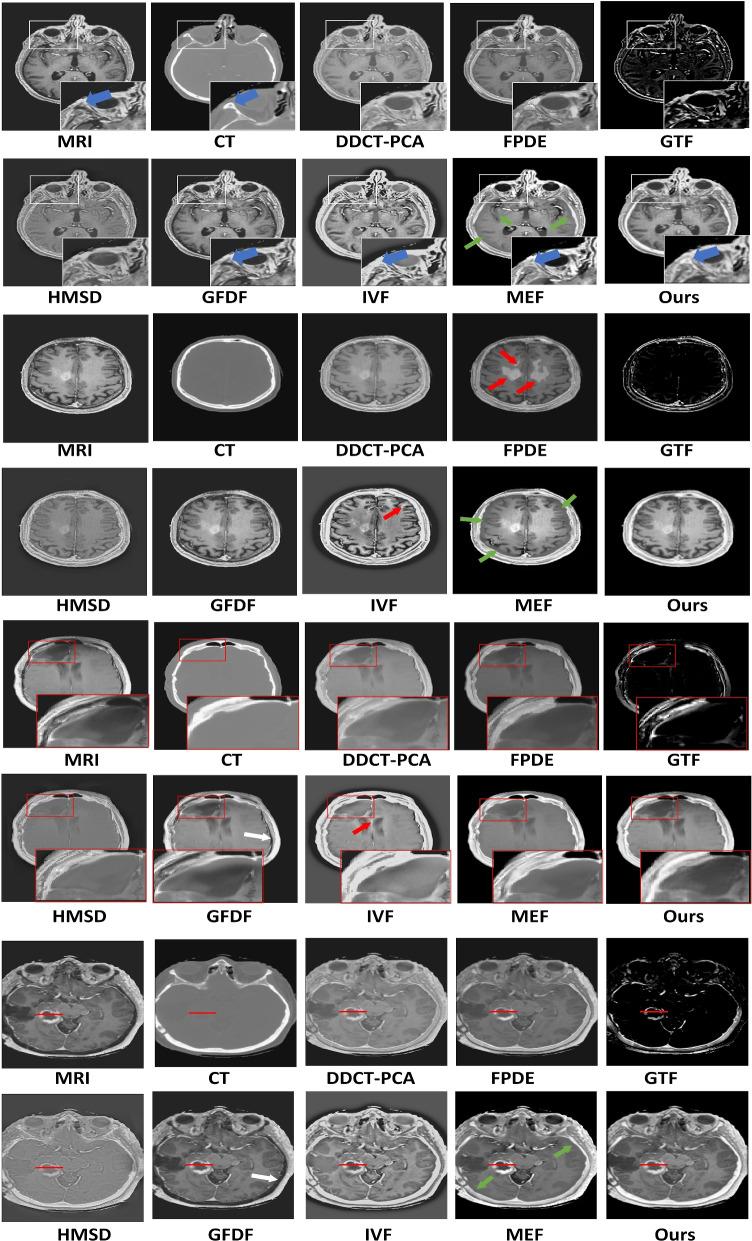https://cdn.ncbi.nlm.nih.gov/pmc/blobs/7249/10704723/3f86e3a3798a/12880_2023_1160_Fig4_HTML.jpg