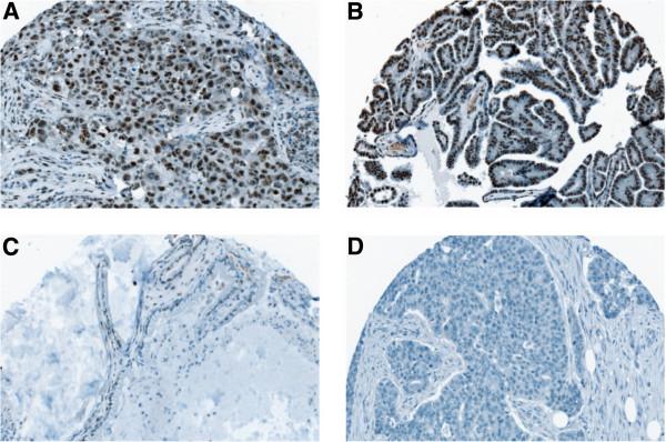 https://cdn.ncbi.nlm.nih.gov/pmc/blobs/7249/3605348/040c94ad408a/1471-2407-13-115-1.jpg