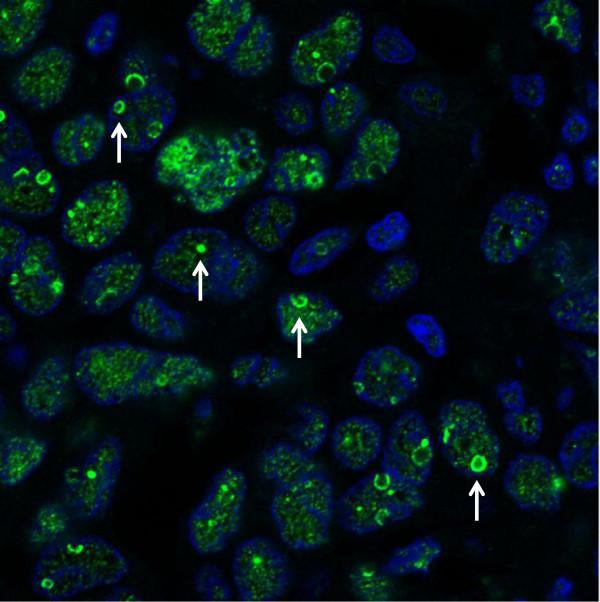 https://cdn.ncbi.nlm.nih.gov/pmc/blobs/7249/3605348/4065def46a64/1471-2407-13-115-2.jpg