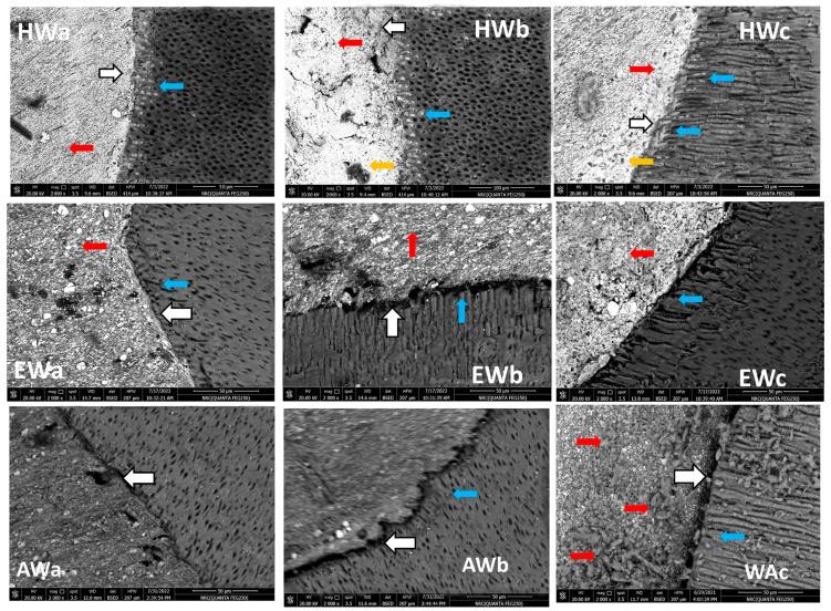 https://cdn.ncbi.nlm.nih.gov/pmc/blobs/724b/11122194/1b2c9b881314/jfb-15-00134-g003.jpg