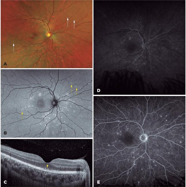 https://cdn.ncbi.nlm.nih.gov/pmc/blobs/724b/11826562/d1e84369b8db/abo-85-02-0186-g01.jpg