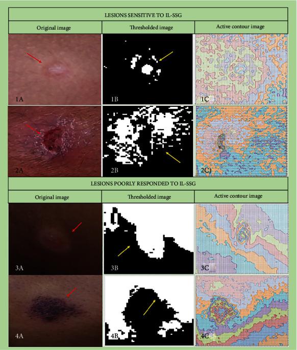 https://cdn.ncbi.nlm.nih.gov/pmc/blobs/724c/8643237/8775e847a7b6/CMMM2021-4208254.003.jpg